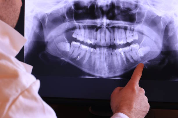 Best Emergency Dental Extractions in Brookfield, NJ
