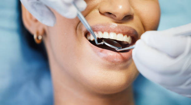 Best Emergency Dentist for Knocked-Out Tooth in Brookfield, NJ